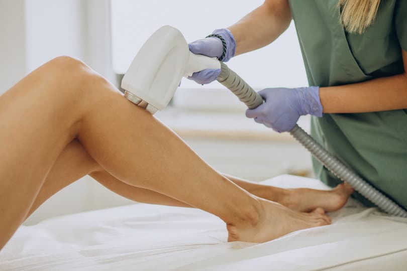 Epilazione Laser